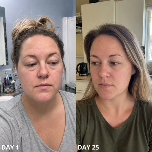 Lymphatic Drainage Drops